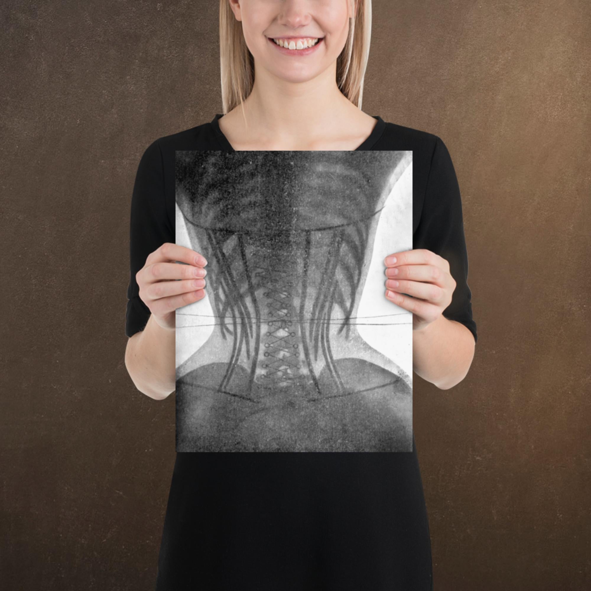 Corset X-ray II, Victorian Dark Academia, Museum-quality Matte Poster Print, Available in Multiple Sizes