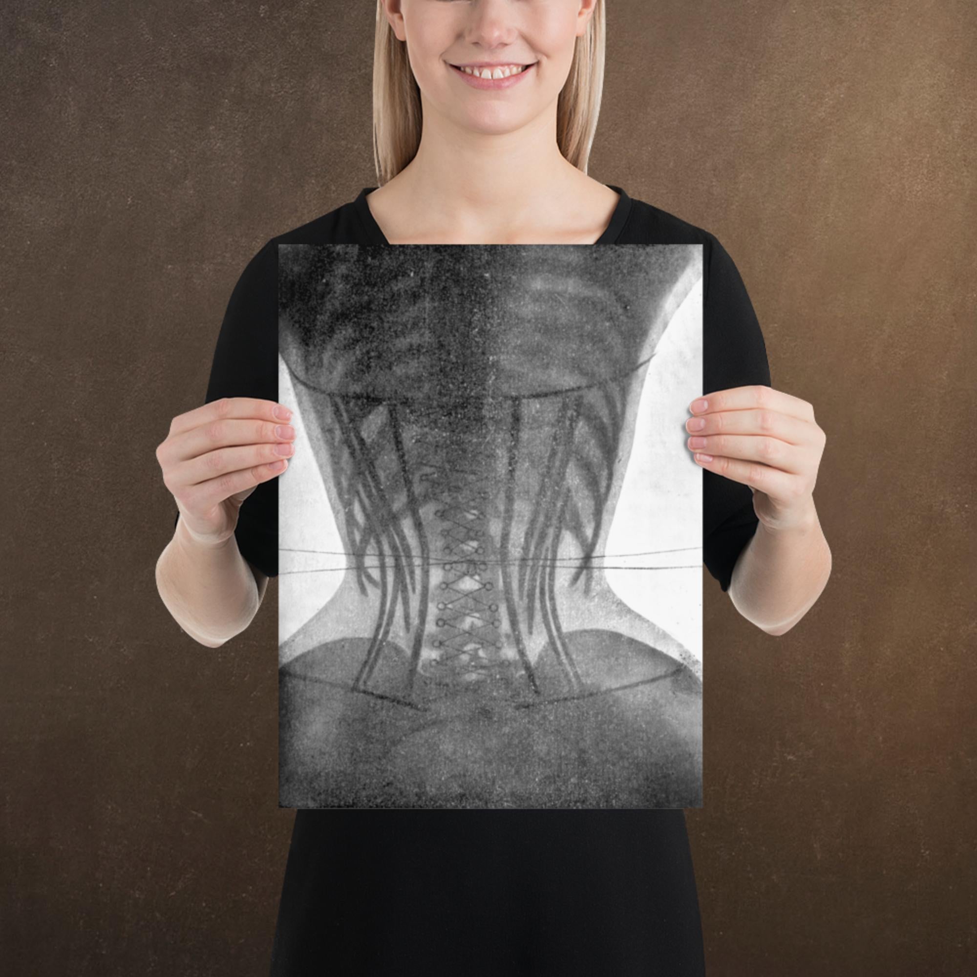 Corset X-ray II, Victorian Dark Academia, Museum-quality Matte Poster Print, Available in Multiple Sizes