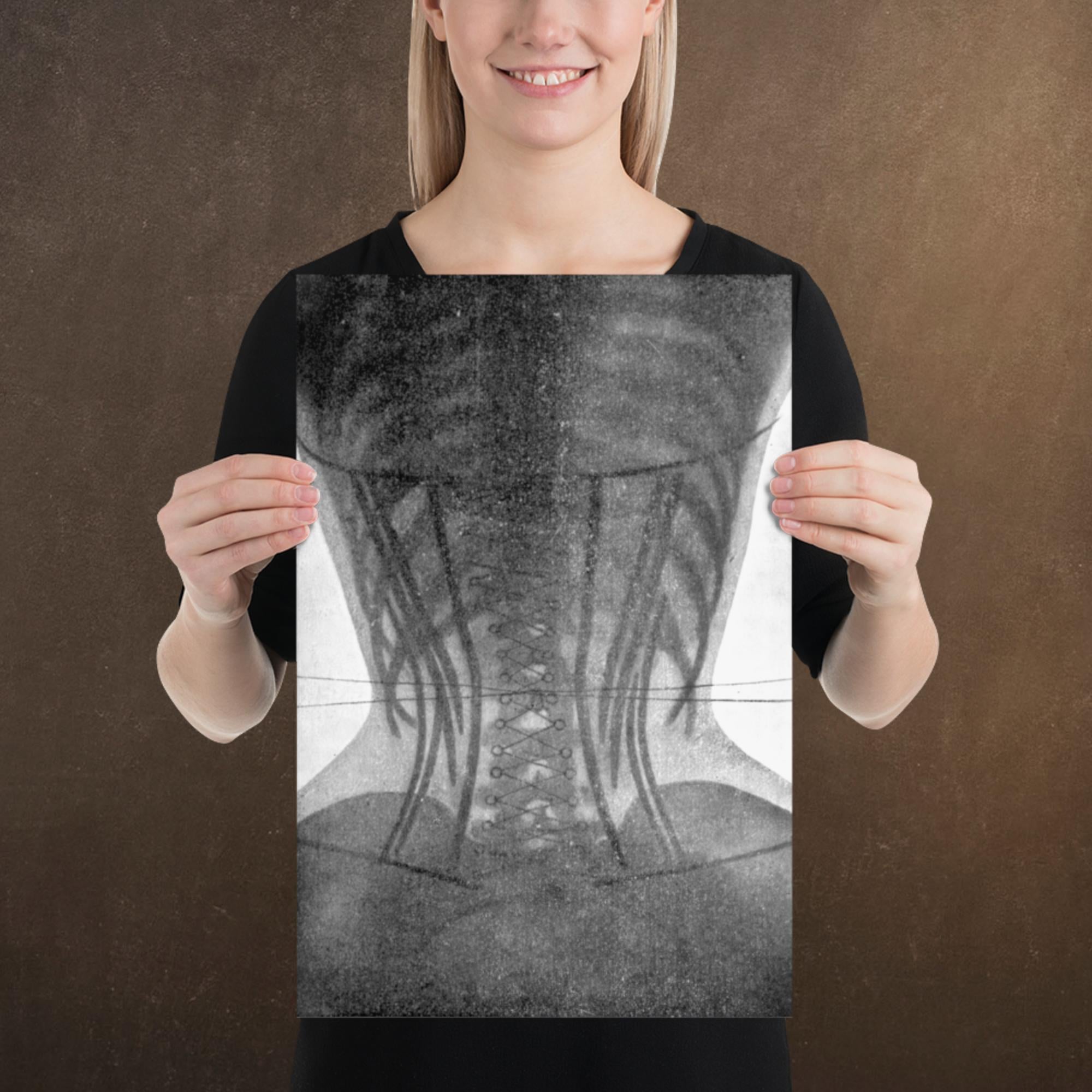 Corset X-ray II, Victorian Dark Academia, Museum-quality Matte Poster Print, Available in Multiple Sizes