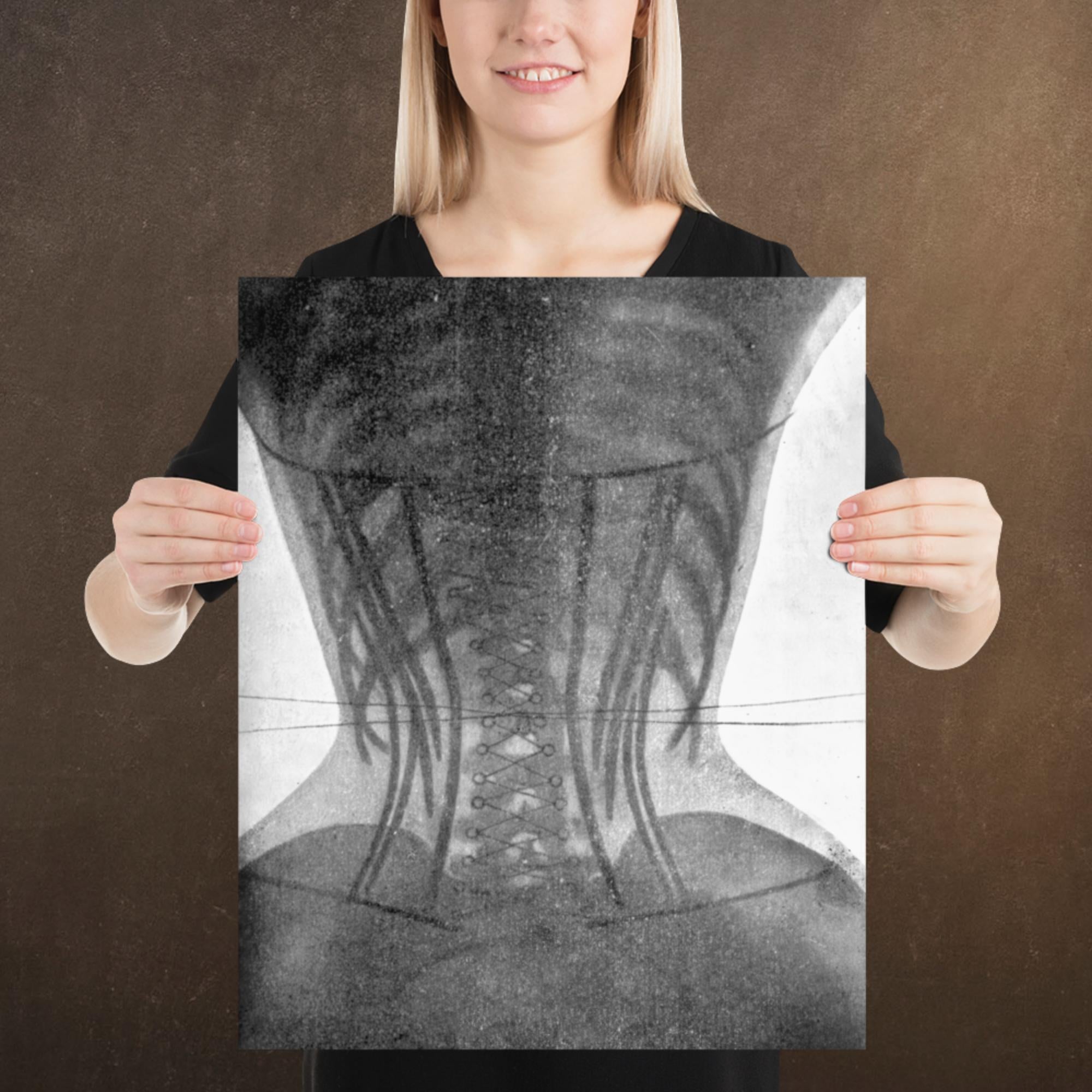 Corset X-ray II, Victorian Dark Academia, Museum-quality Matte Poster Print, Available in Multiple Sizes