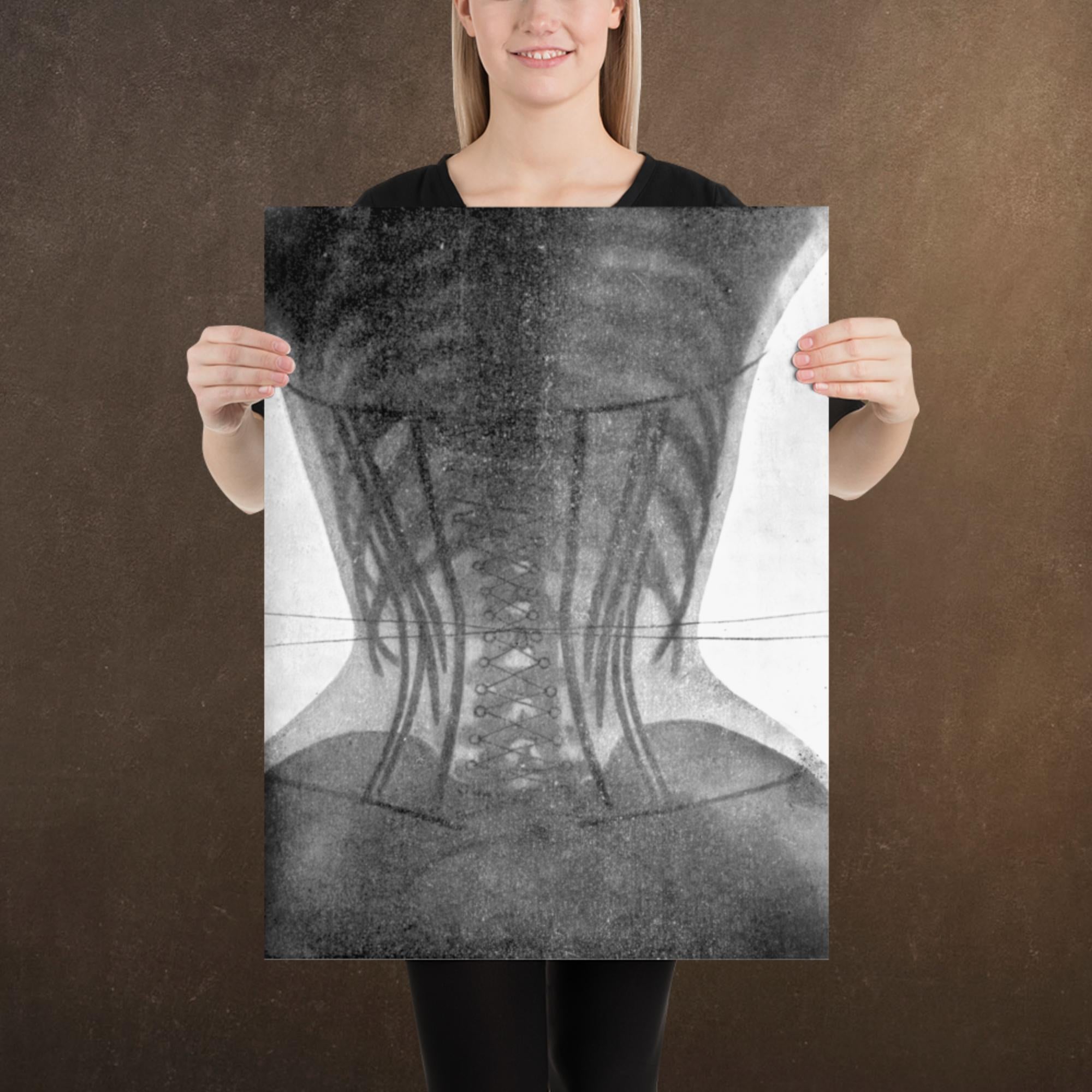 Corset X-ray II, Victorian Dark Academia, Museum-quality Matte Poster Print, Available in Multiple Sizes