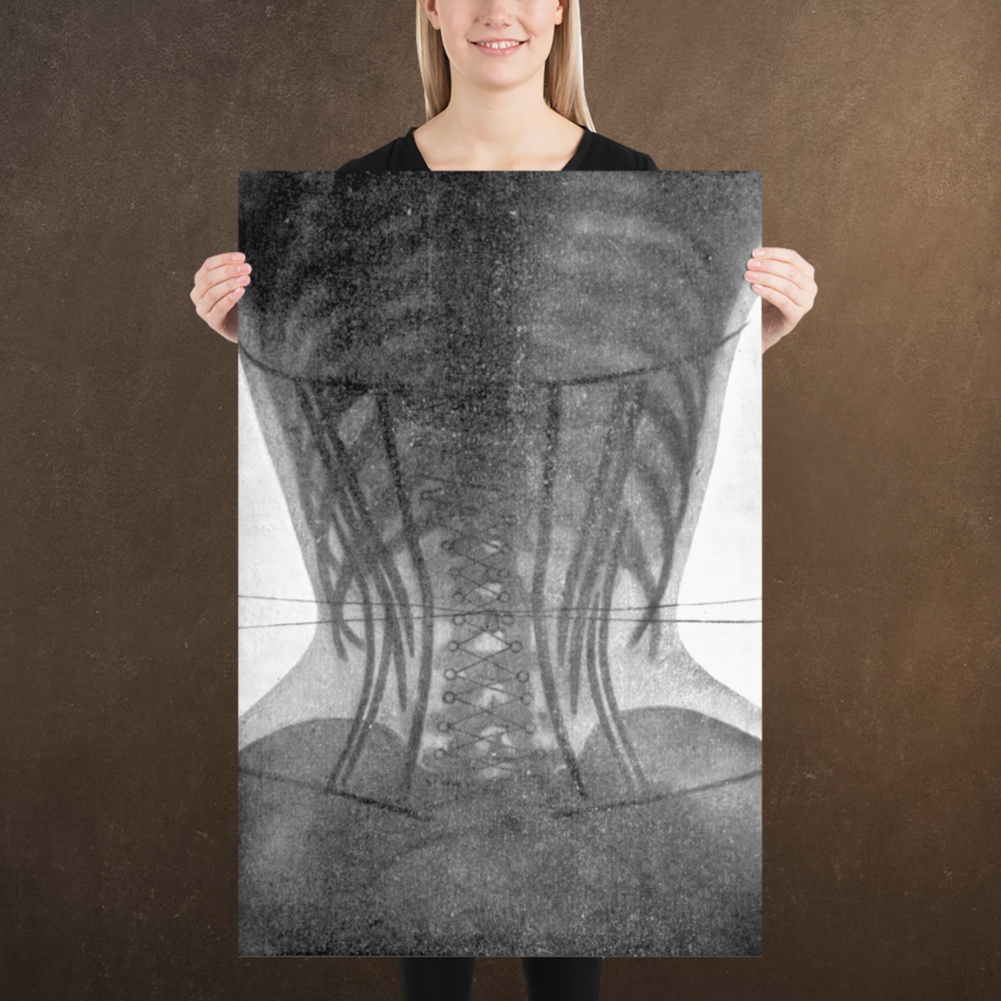 Corset X-ray II, Victorian Dark Academia, Museum-quality Matte Poster Print, Available in Multiple Sizes