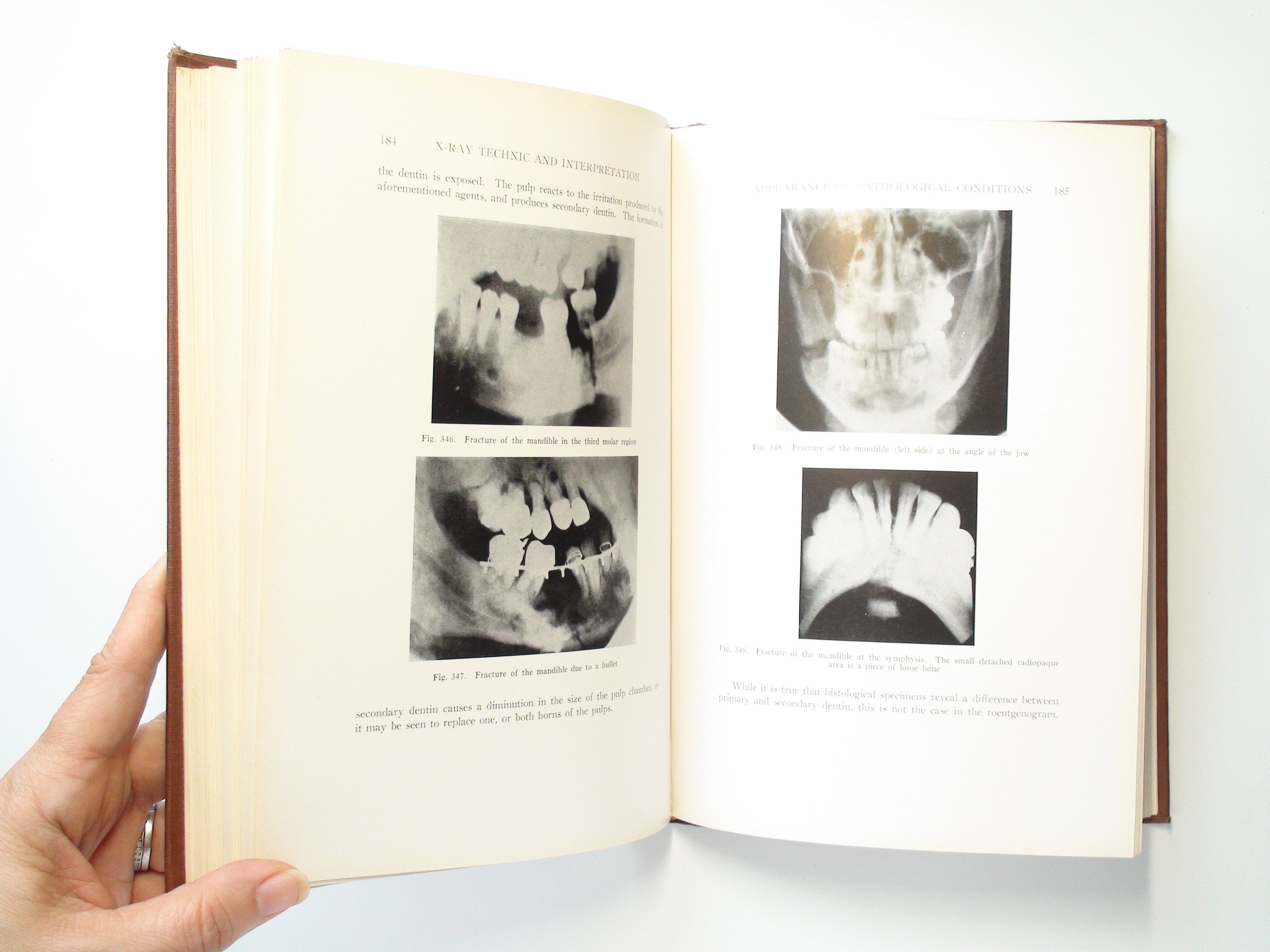 X-Ray Technic And Interpretation of Dental Roentgenograms, Greenfield, 1938